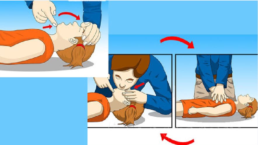 Cách sơ cứu người bị sét đánh là rất cần thiết